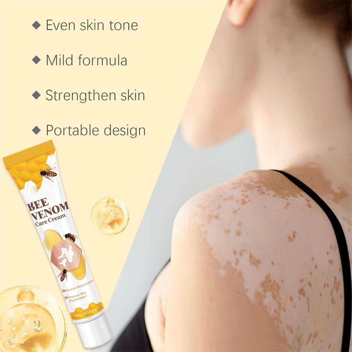 Vitigo Bee Venom Cream | Skin Repair, Hydration & Anti-Irritation