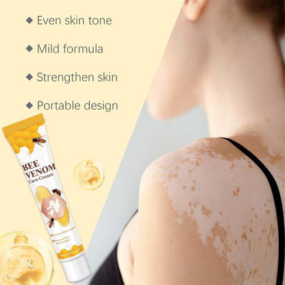 Vitigo Bee Venom Cream | Skin Repair, Hydration & Anti-Irritation