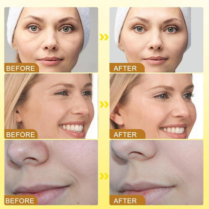 Botox Bee Venom Wrinkle Cream | Anti-Aging & Collagen Boost Moisturizer